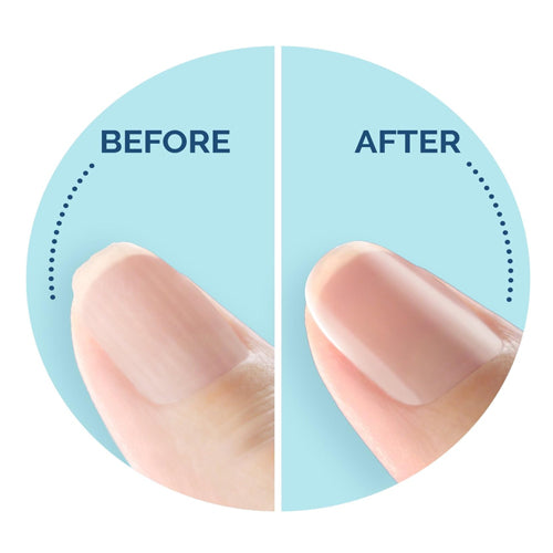 Scholl Electronic Nail Care System