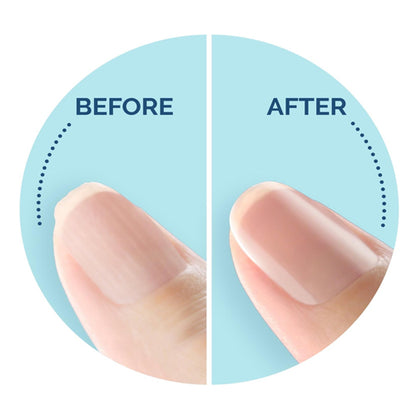 Scholl Electronic Nail Care System